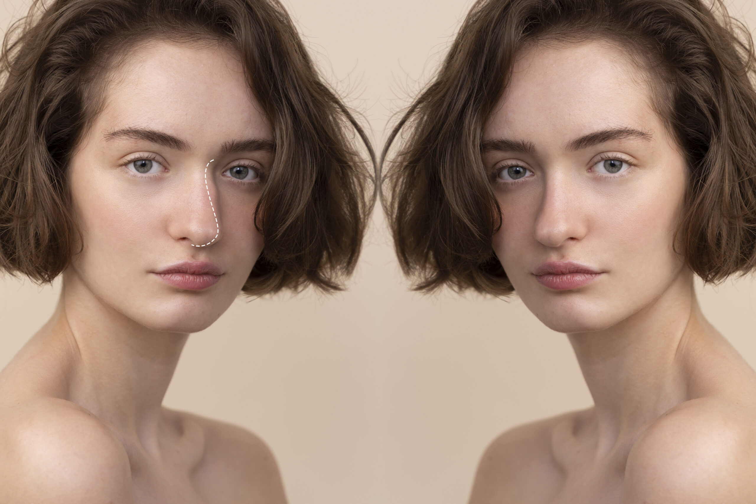 A comparison photo showcasing facelifts & non-invasive options