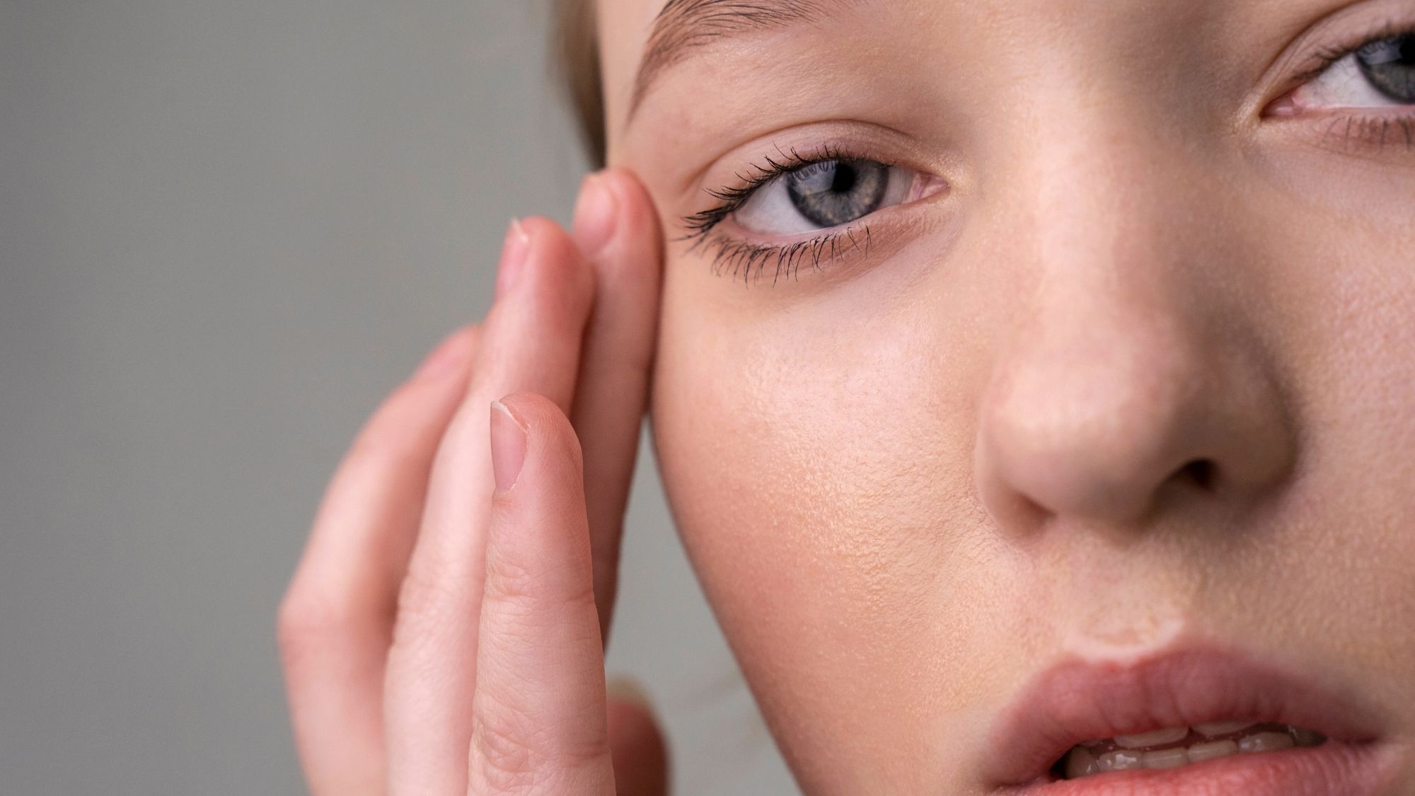 A girl holding her eye, suffering from Botox and Ptosis