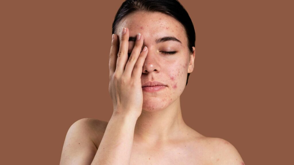 A woman hiding her face with one hand because of rough skin and skin care issues