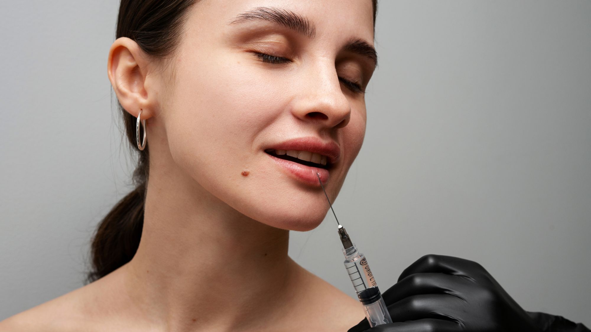 Professional lip filler session with a clinician injecting dermal filler into a woman’s lips