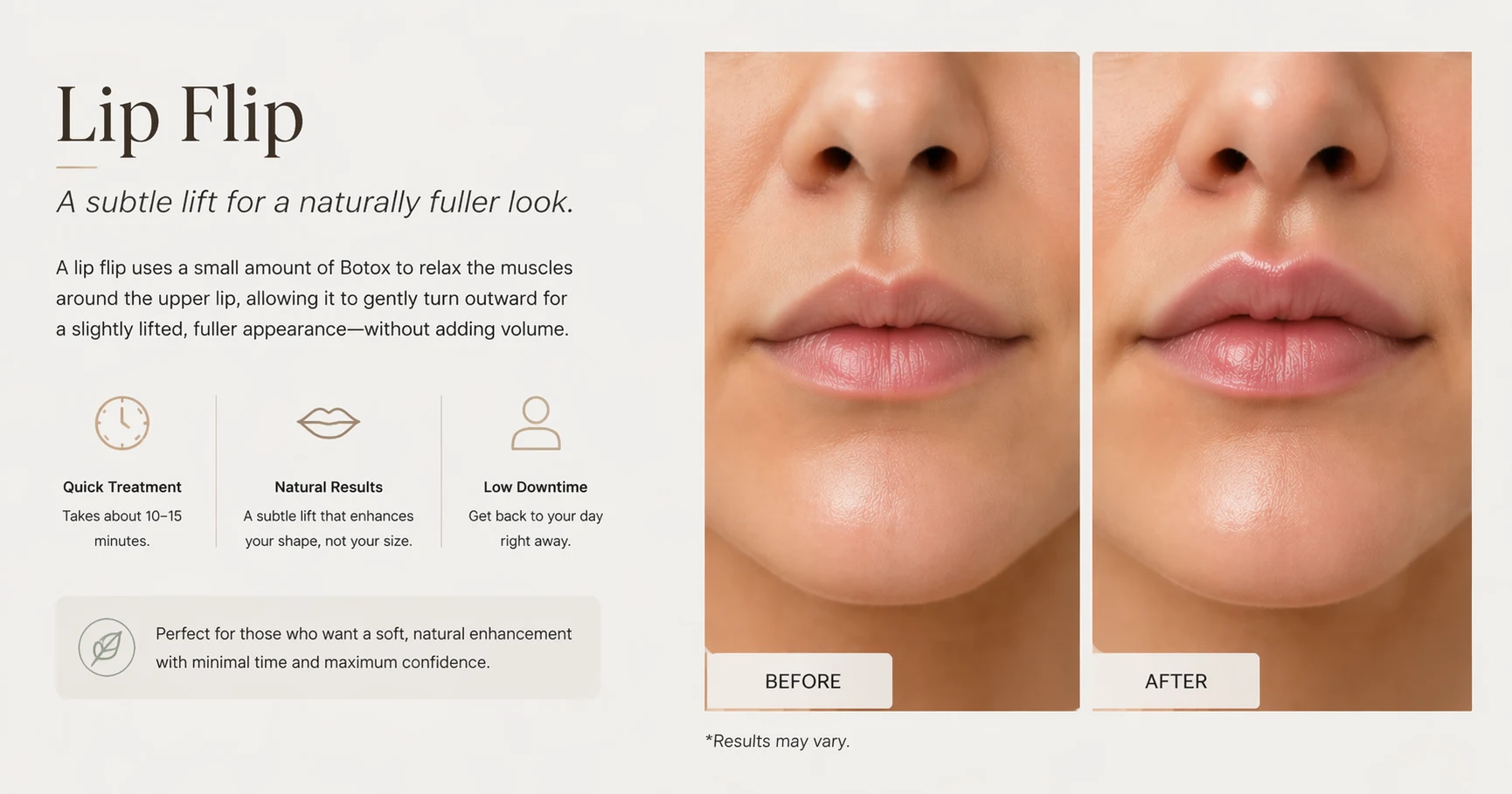 Before and after image showcasing a subtle lip lift from the Lip Flip procedure. The treatment enhances the upper lip's natural shape without adding volume, offering a fuller and lifted appearance with minimal downtime.